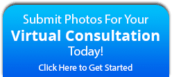 Virtual Consultation Orthodontically Yours in Mississauga Thornhill ON
